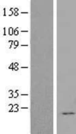 Novus Biologicals FGF-12 Overexpression Lysate 0.1mg | Buy Online | Novus Biologicals&trade; | Fisher Scientific