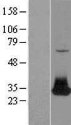 Novus Biologicals&trade;&nbsp;FGF-12 Overexpression Lysate