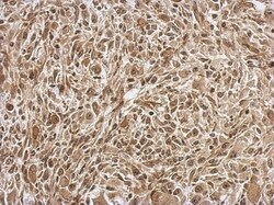 FGF-13 Antibody, Novus Biologicals 0.1mL; Unlabeled:Antibodies, Polyclonal