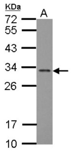 FGF-13 Antibody, Novus Biologicals 0.1mL; Unlabeled:Antibodies, Polyclonal