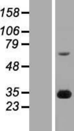 Novus Biologicals&trade;&nbsp;FGF14 Overexpression Lysate