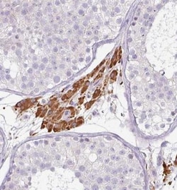 FGF-17 Antibody, Novus Biologicals:Antibodies:Primary Antibodies