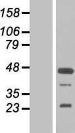 Novus Biologicals™ FGF-19 Overexpression Lysate