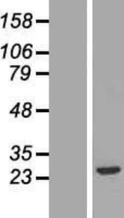 Novus Biologicals&trade;&nbsp;FGF-20 Overexpression Lysate