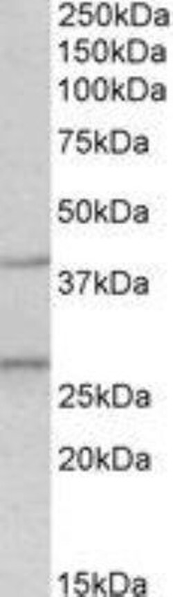 FGF-23 Antibody, Novus Biologicals 0.1mg; Unlabeled:Antibodies, Polyclonal
