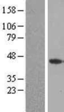 Novus Biologicals&trade;&nbsp;FGF-4 Overexpression Lysate