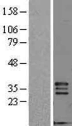 Novus Biologicals&trade;&nbsp;FGF-5 Overexpression Lysate