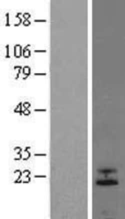 Novus Biologicals&trade;&nbsp;FGF-6 Overexpression Lysate
