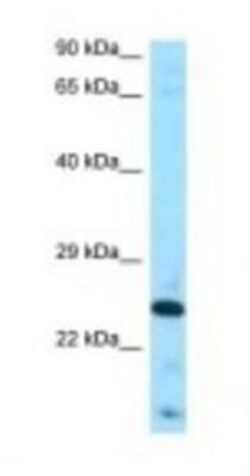 FGF-8 Antibody, Novus Biologicals 100&mu;L; Unlabeled:Antibodies, Polyclonal