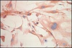 FGF basic/FGF2/bFGF Antibody, Novus Biologicals 0.1 mL | Buy Online | Novus Biologicals | Fisher Scientific