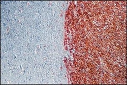 FGF basic/FGF2/bFGF Antibody, Novus Biologicals 0.1 mL | Buy Online | Novus Biologicals | Fisher Scientific