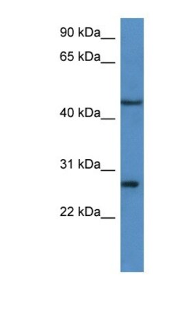 FGFBP2 Antibody, Novus Biologicals:Antibodies:Primary Antibodies