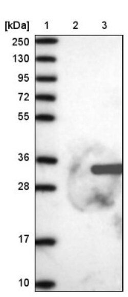 FGFBP2 Antibody, Novus Biologicals:Antibodies:Primary Antibodies