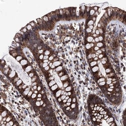 FGFBP2 Antibody, Novus Biologicals:Antibodies:Primary Antibodies