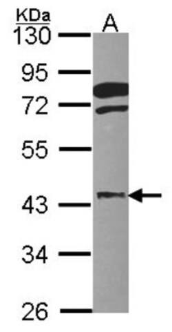 FGFR1OP Antibody, Novus Biologicals 0.1mL; Unlabeled:Antibodies, Polyclonal
