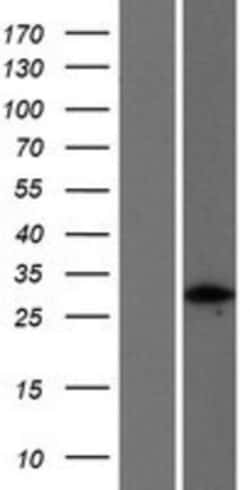Novus Biologicals&trade;&nbsp;FGFR1OP2 Overexpression Lysate