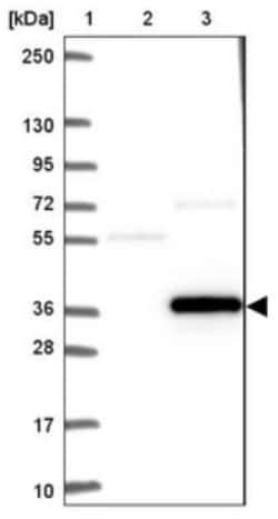 FGFR1OP2 Antibody, Novus Biologicals:Antibodies:Primary Antibodies