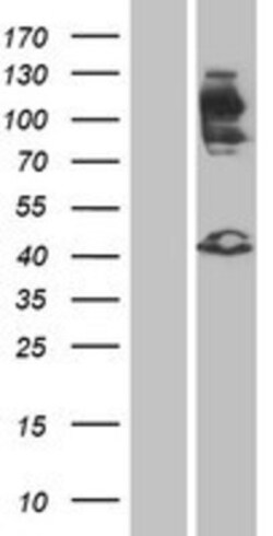 Novus Biologicals&trade;&nbsp;FGFR2 Overexpression Lysate