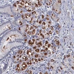 FGFR2 Antibody, Novus Biologicals 0.1mL; Unlabeled:Antibodies, Polyclonal