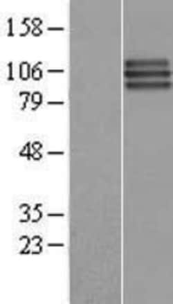 Novus Biologicals&trade;&nbsp;FGFR3 Overexpression Lysate
