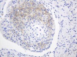 FGFR3 Antibody (OTI1B10), Novus Biologicals 0.1mL; Unlabeled:Antibodies,