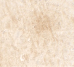 FGFR3 Antibody - BSA Free, Novus Biologicals:Antibodies:Primary Antibodies