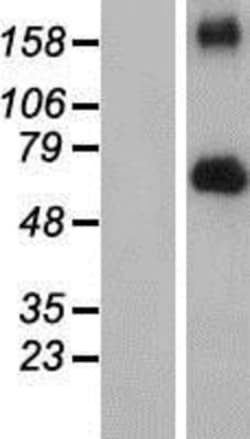 Novus Biologicals&trade;&nbsp;FGFR4 Overexpression Lysate
