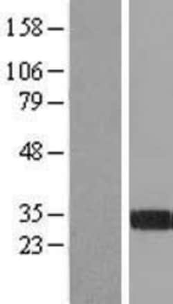 Novus Biologicals™ Hepassocin/FGL1 Overexpression Lysate