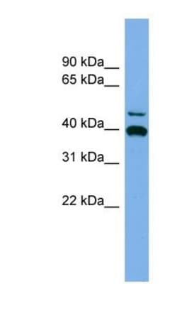 FGL2/Fibroleukin Antibody, Novus Biologicals 100&mu;L; Unlabeled:Antibodies,
