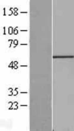 Novus Biologicals&trade;&nbsp;Fgr Overexpression Lysate