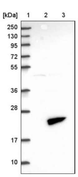 FHIT Antibody, Novus Biologicals:Antibodies:Primary Antibodies