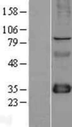 Novus Biologicals&trade;&nbsp;FHL1 Overexpression Lysate