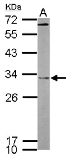 FHL2 Antibody, Novus Biologicals 0.1mL; Unlabeled:Antibodies, Polyclonal