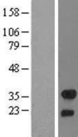 Novus Biologicals&trade;&nbsp;FHL2 Overexpression Lysate
