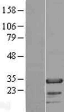 Novus Biologicals&trade;&nbsp;FHL2 Overexpression Lysate