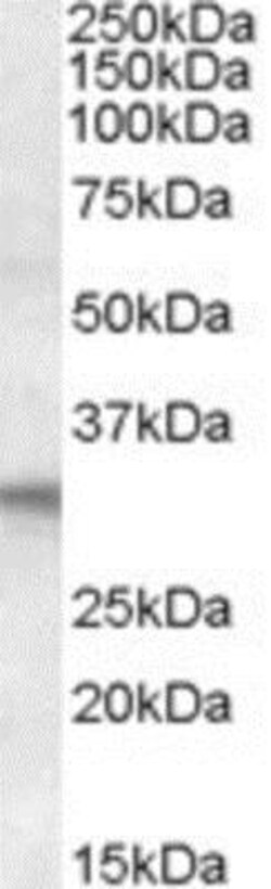 FHL2 Antibody, Novus Biologicals 0.1mg; Unlabeled:Antibodies, Polyclonal