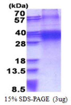 Novus Biologicals&trade;&nbsp;Recombinant Human FHL3 His Protein
