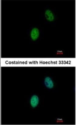 FHL5 Antibody, Novus Biologicals 0.1mg; Unlabeled:Antibodies, Polyclonal