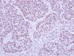 FHL5 Antibody, Novus Biologicals 0.1mg; Unlabeled:Antibodies, Polyclonal