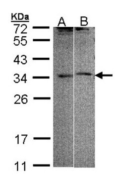 FHL5 Antibody, Novus Biologicals 0.1mg; Unlabeled:Antibodies, Polyclonal