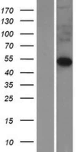 Novus Biologicals&trade;&nbsp;FIBCD1 Overexpression Lysate