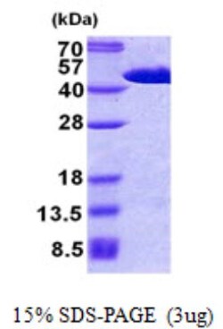 Novus Biologicals&trade;&nbsp;Recombinant Human FIBP His Protein