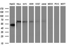 Fibrinogen gamma chain Antibody (OTI2D2), Novus Biologicals 0.1mL; Unlabeled:Antibodies,