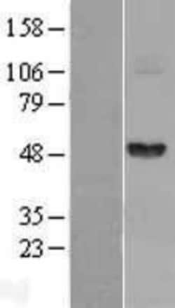 Novus Biologicals™ Fibrinogen gamma chain Overexpression Lysate