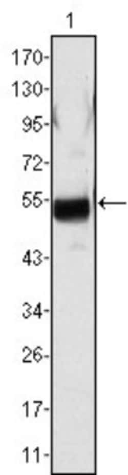 Fibrinogen beta chain Antibody (1F9), Novus Biologicals 0.025 mL, Unconjugated:Antibodies,