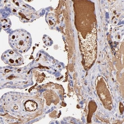 Fibrinogen beta chain Antibody, Novus Biologicals 0.1 mL | Buy Online | Novus Biologicals | Fisher Scientific