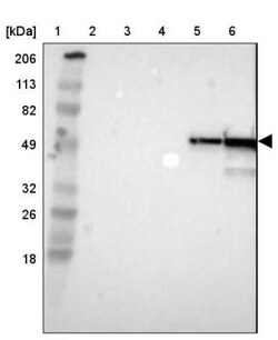Fibrinogen beta chain Antibody, Novus Biologicals 0.1 mL | Buy Online | Novus Biologicals | Fisher Scientific
