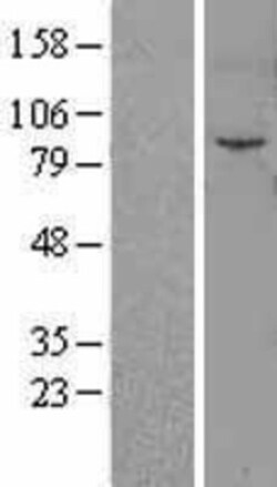 Novus Biologicals&trade;&nbsp;Fibroblast Activation Protein alpha/FAP Overexpression Lysate