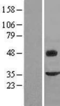 Novus Biologicals&trade;&nbsp;Fibromodulin/FMOD Overexpression Lysate