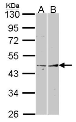 Fibromodulin/FMOD Antibody, Novus Biologicals 0.1mL; Unlabeled:Antibodies,